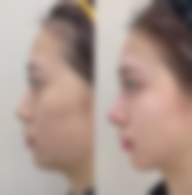 青岛本沐医疗整形美容诊所价格表