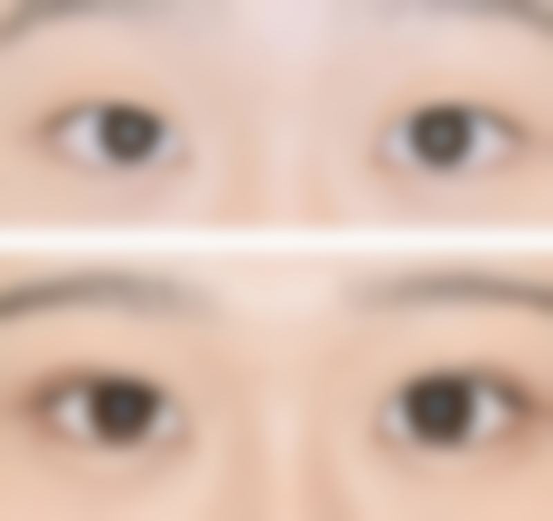 补充胶原蛋白,促进了胶原蛋白的合成。