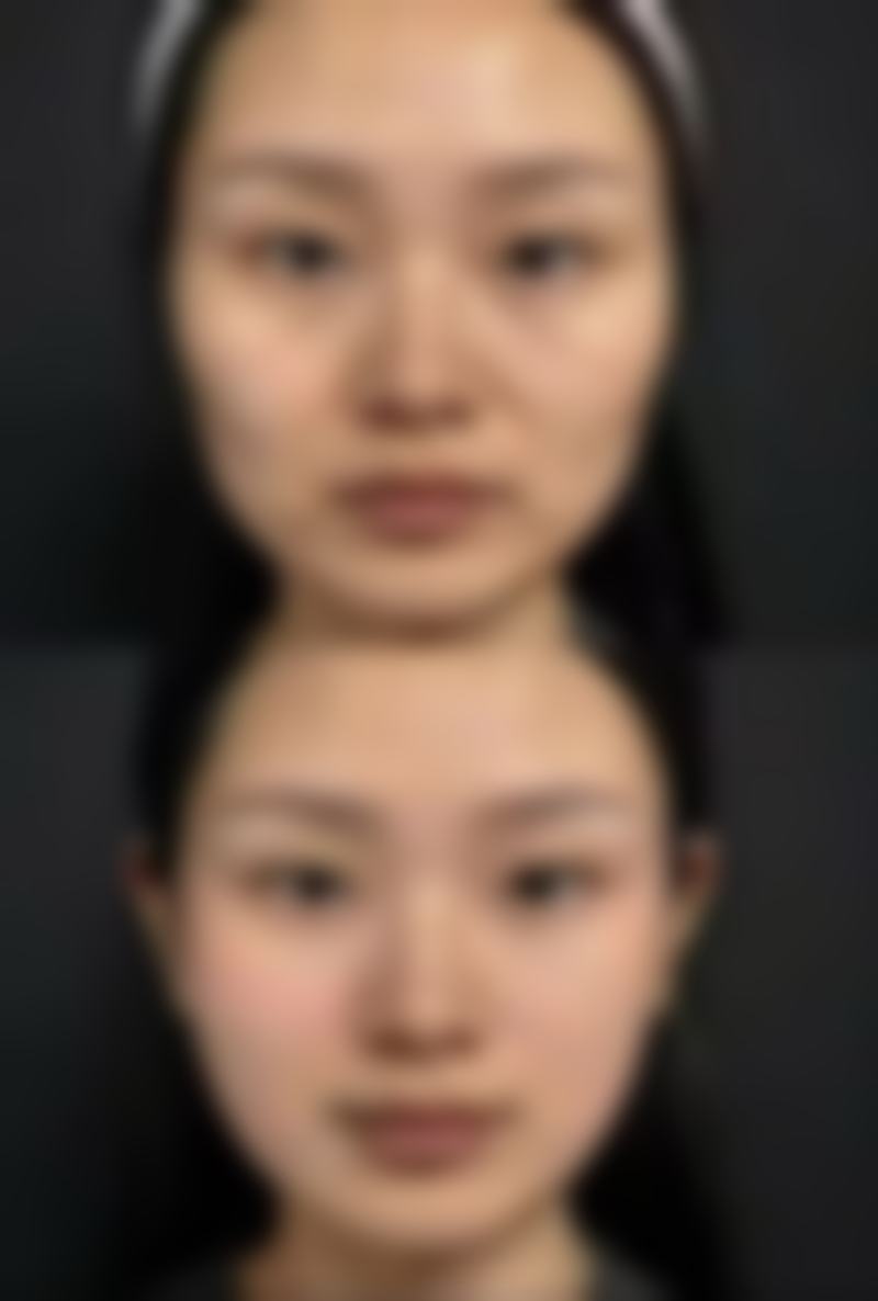 补充胶原蛋白,促进了胶原蛋白的合成。