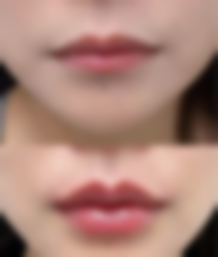 常秀芬医生做手术价格