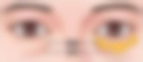 抽脂隆胸对神经系统有害吗——皮肤感觉的“信号中断”