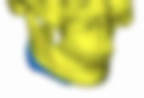 崔正军 医生简介做手术价格