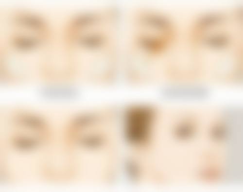 告别疤痕,重拾自信!