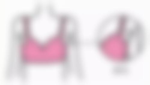 面部缝针疤痕激光修复成效真实实例呈现