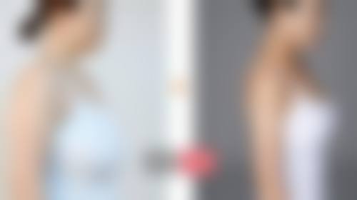 济南云亿雨曼整形医院价格表