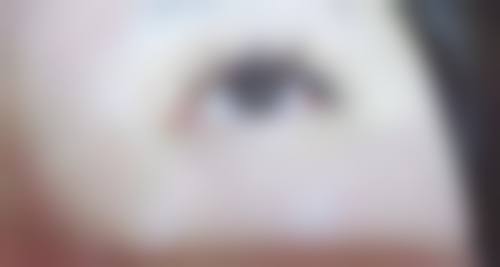 曹畅医生做手术价格