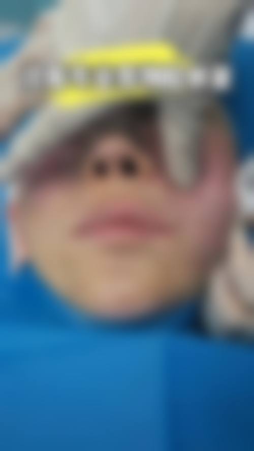 南昌曹志明整形医疗美容诊所更擅长什么手术