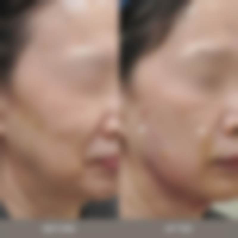 韩国jiwoo皮肤科口碑好不好