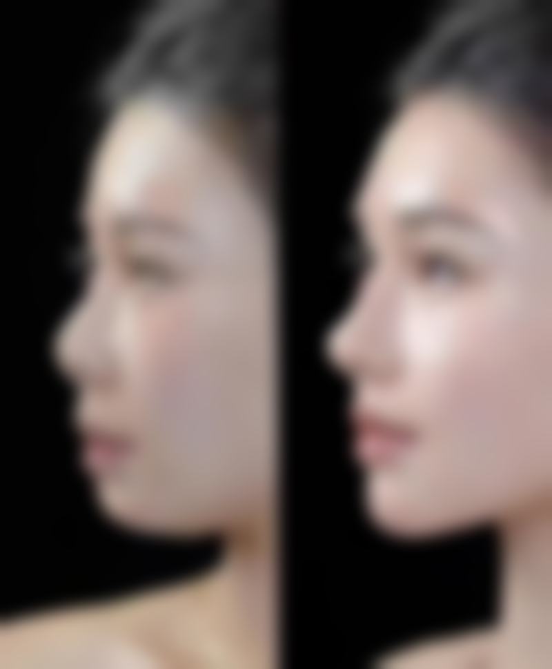 曹畅医生项目优势