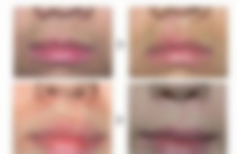 周玉珊医生项目优势体现