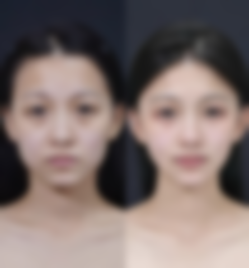 王晓平医生简介项目优势