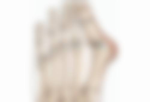 如果女人有眼袋怎样祛除：手术方案大PK，哪种更适合你？