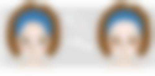 老年人下眼袋大怎么回事？竟是衰老+遗传惹的祸，3招轻松改善！