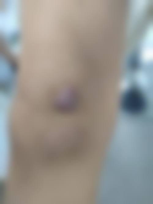 吴龙范医生口碑如何