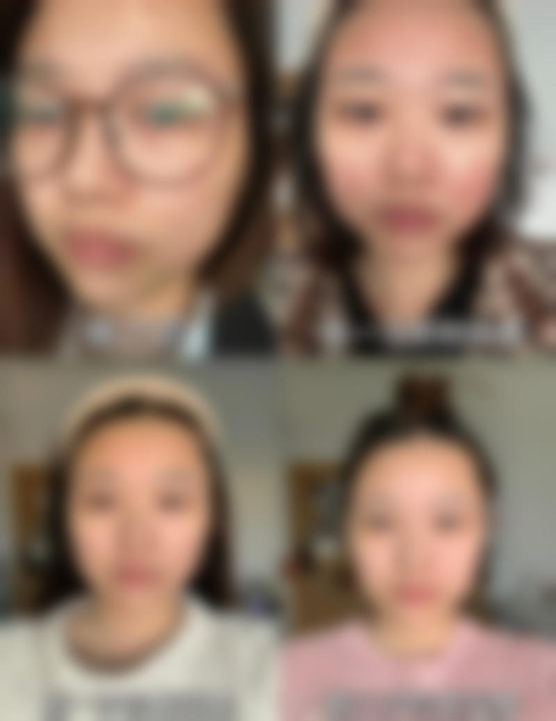 朱红医生简介做手术价格