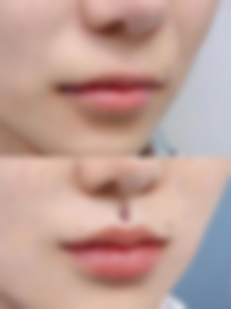 韩国RE&YOUNG皮肤科怎么样，抖音团购活动和价格表