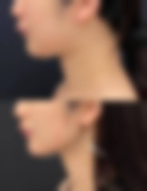 兰州圣莫丽斯美容门诊部特色项目优势