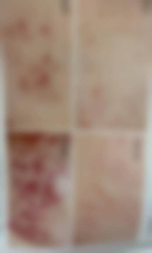 昆明心颜塑美医疗美容门诊部特色项目有哪些