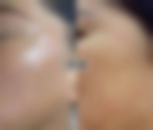 乔福萌医生做手术价格