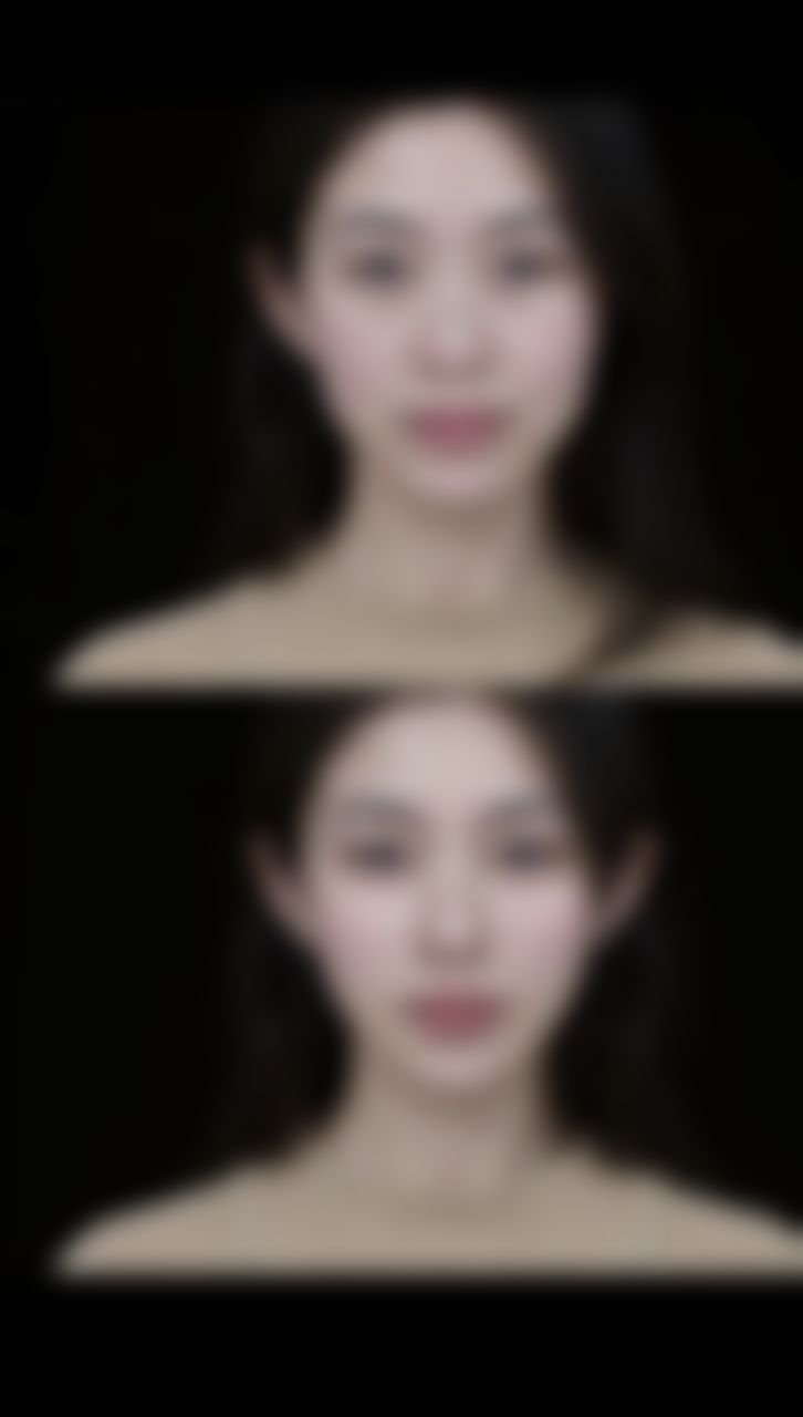 尾段：告别痘疤，重拾自信