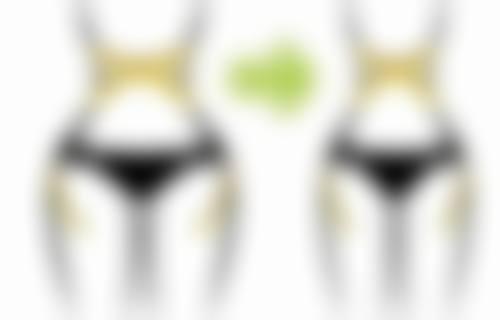 割双眼皮和割眼袋联合手术：真实实例参考