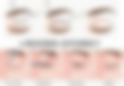 焦志云医生简介做手术价格