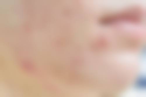 乔海侠医生项目优势