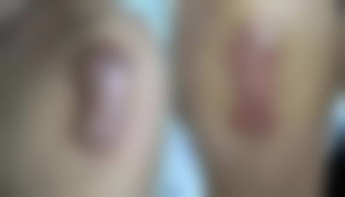 乔海侠医生口碑如何