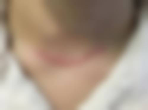 刘燕婷医生简介口碑如何