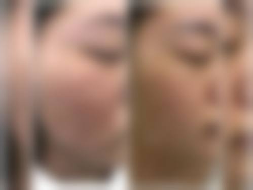 俞惠忠医生简介口碑如何