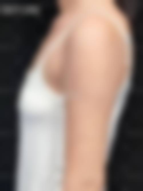 潮州韩美整形医院价格表