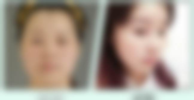 北京禾美嘉医疗美容门诊部贺天遥收费贵不贵——北京润美玉之光医疗美容门诊部