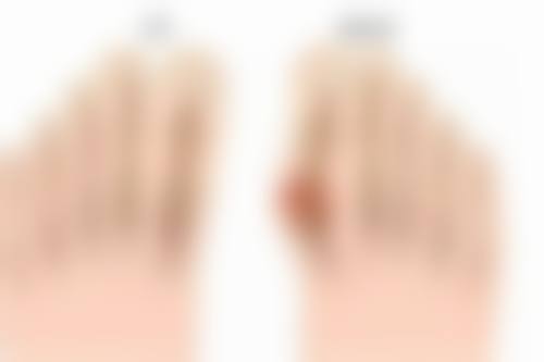 瘦脸针100u品牌选择攻略