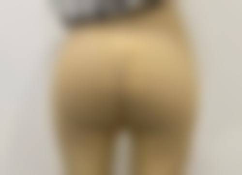 瘦脸针100u成效预期全知晓