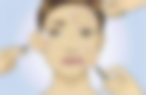 严重的眼袋怎么去？三甲医院推荐+冬瓜黑鱼羹食疗方拯救松弛眼周