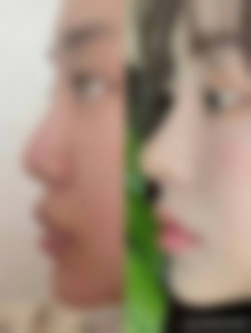 杭州悦可医疗美容诊所陈彩媛医生优势：安心守护美丽，传递严谨温柔