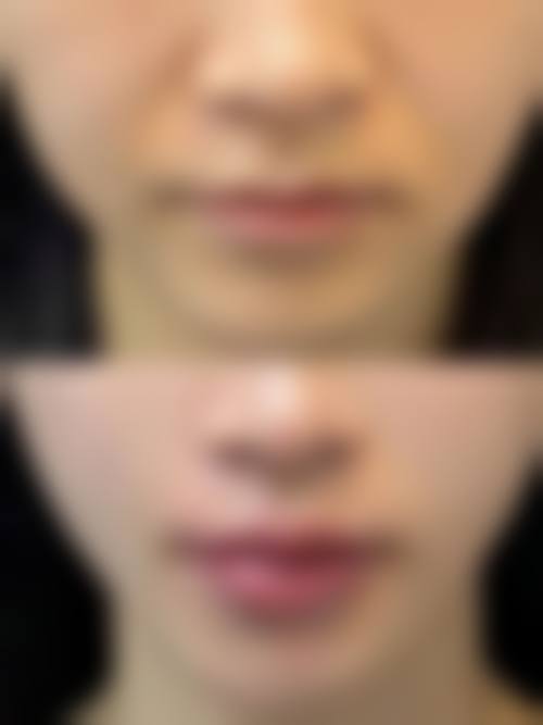 厦门思明星美会整形医院口碑好不好?附真实患者口碑评价