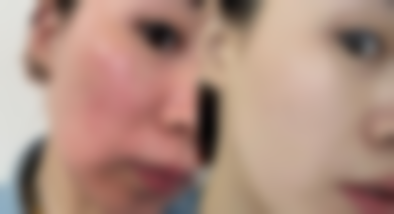 北京泰妃医疗美容诊所更擅长什么手术