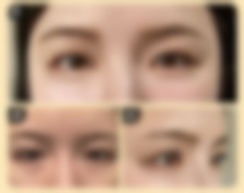 李嘉欣医生怎么挂号