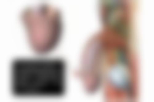 怎么样可以治疤痕之未来展望:医学创新,引领疤痕治疗新时代