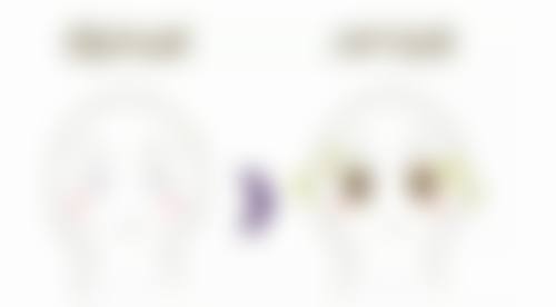 肋骨隆鼻手术要做多长时间，专业医生2-3小时搞定，复杂情况需4小时+