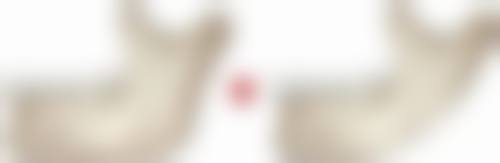 告别“疤”恼,迎接无瑕新生