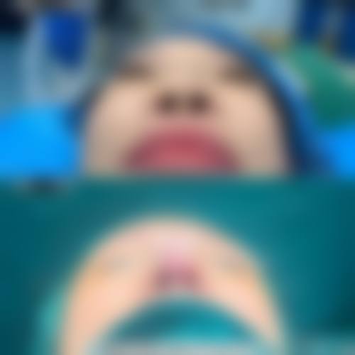 优尼克整形外科手术风格与成效