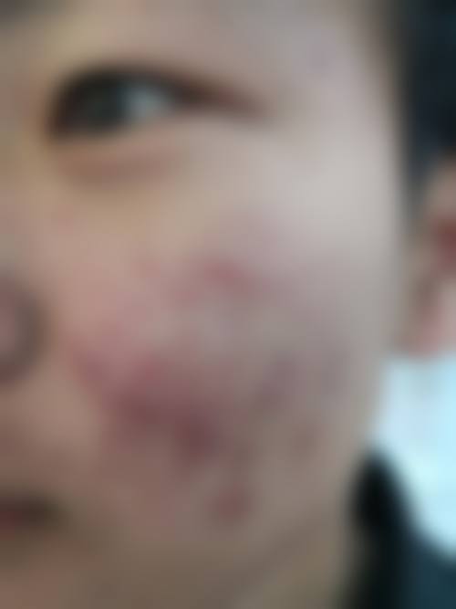 亳州徐立轩整形外科诊所可靠吗