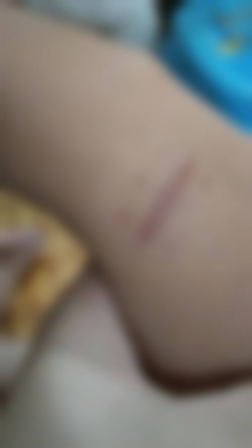 三、东营安美柏妍整形医院怎么样：口碑评价