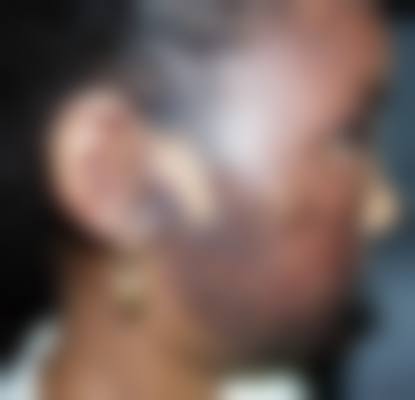 曹思佳医生做手术价格：合理区间，因情而异