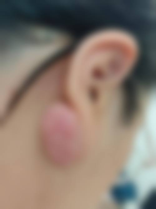 佟淑杰医生项目优势