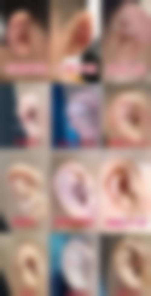 宁德维多利亚整形美容医院口碑好不好？附真实患者口碑评价