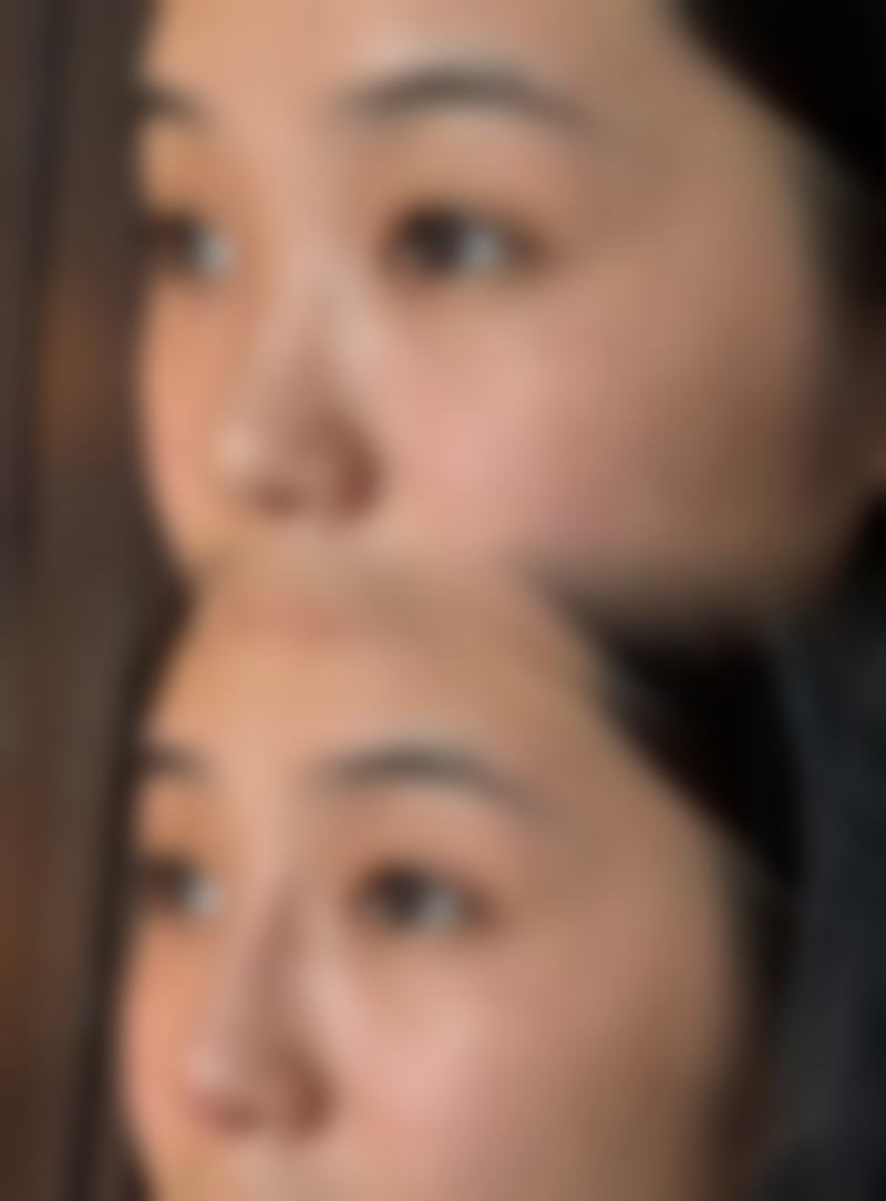 曹思佳医生项目优势：经验多，学术突出