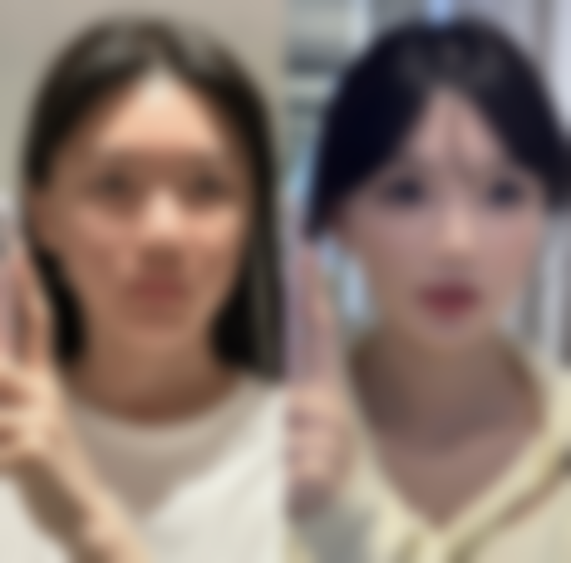 粉毒除皱成效的副作用情况